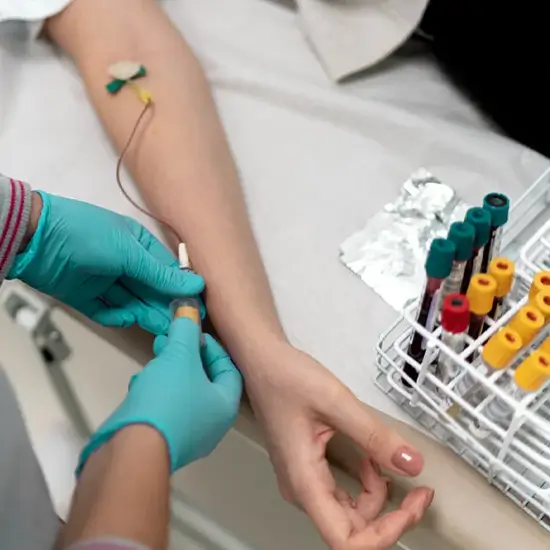 aspergillus antibody igm, serum